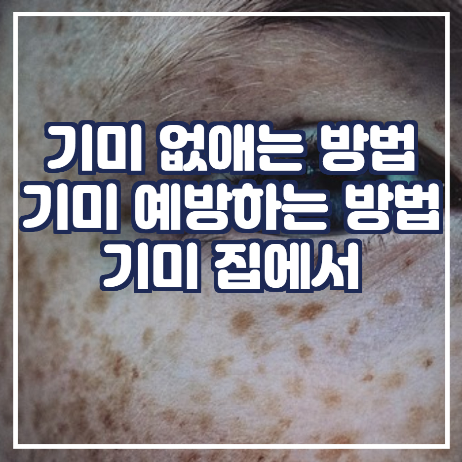  기미 없애는 방법 7가지