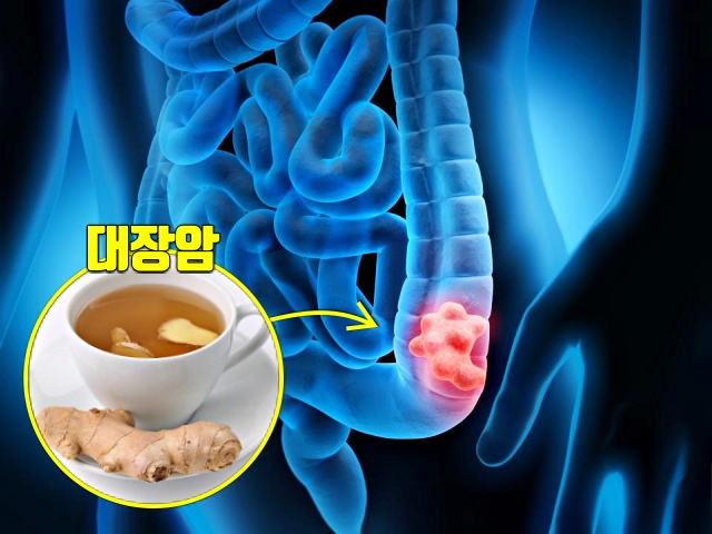 생강차 효능 대장암 예방에 좋은 음식 생강 효능,건강 팁줌 매일꿀정보