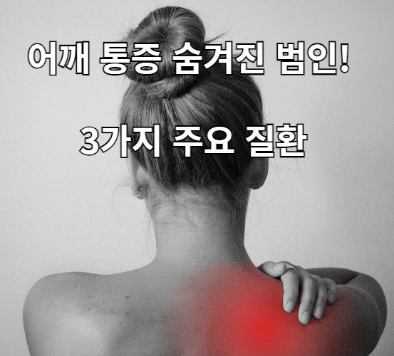 어깨통증 3가지 질환