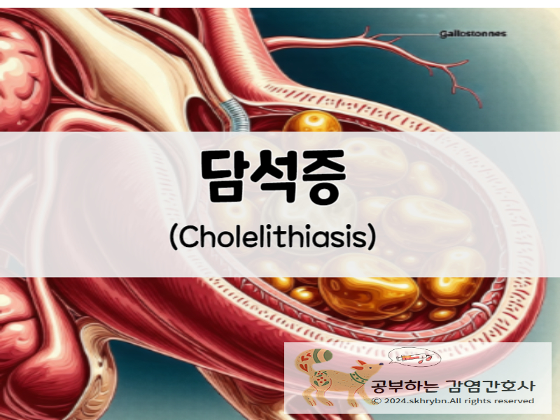 담석증(cholelithiasis)의 원인 및 증상 치료