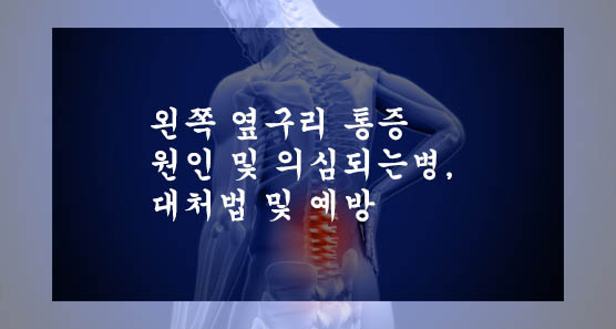  왼쪽 옆구리 통증 원인 및 의심되는병, 대처법 및 예방