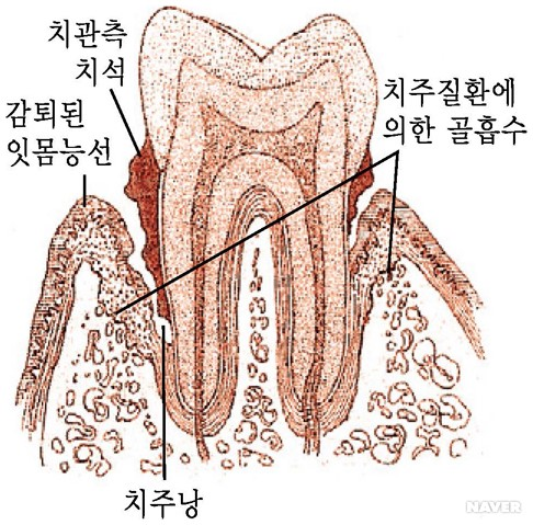 잇몸구조