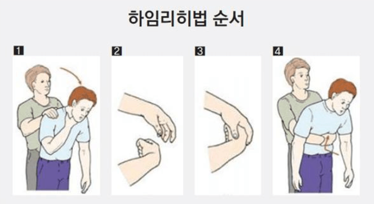 하임리히법칙