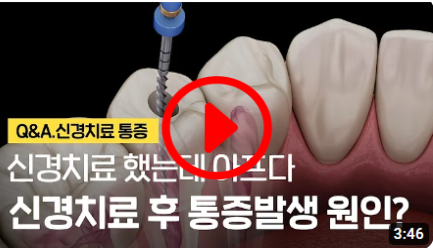 치아 신경치료 후 통증
