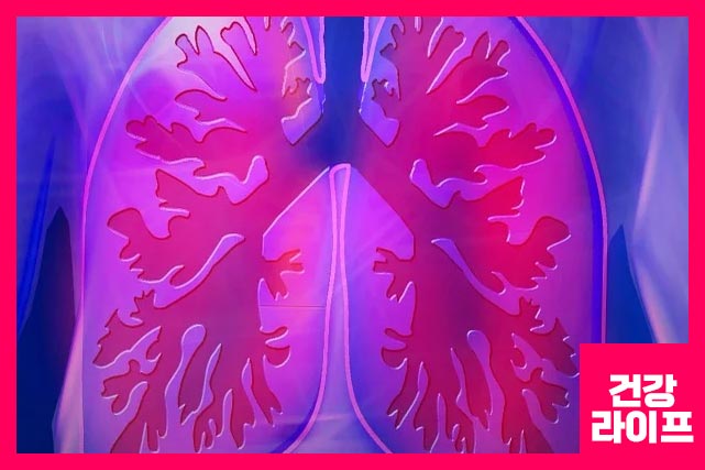 성으로 마른 잔기침이 발생한다면 폐암 증상일 수 있습니다.