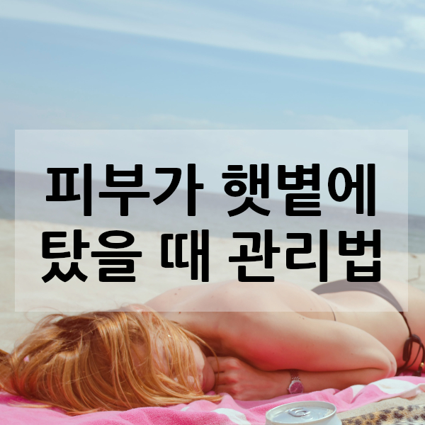 피부 햇볕에 탔을 때 관리 방법 알아보기