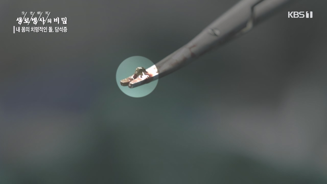 생로병사의 비밀.E886.231019p-NEXT.mp4_20231019_203454.427.jpg