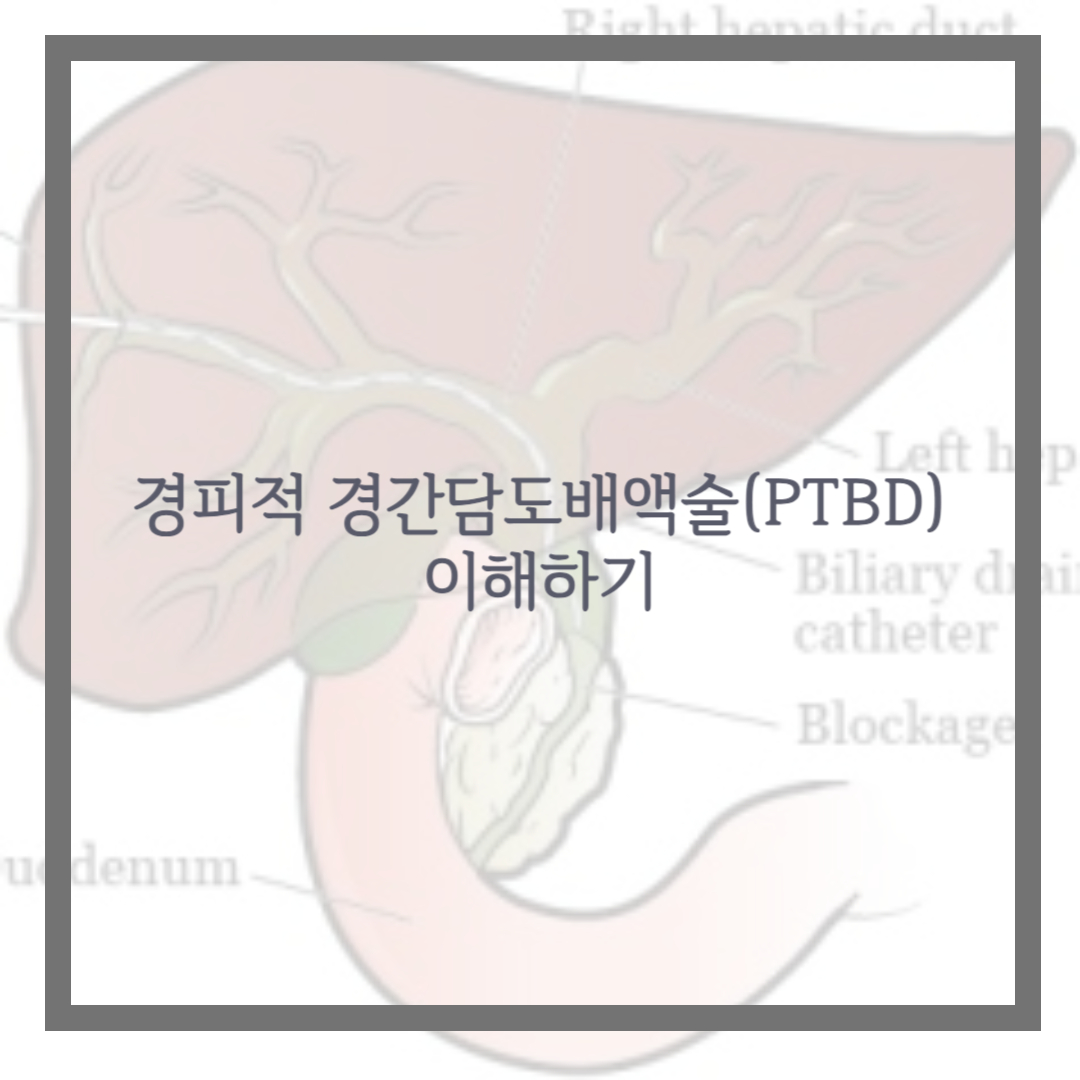 경피적 경간담도배액술(PTBD) 이해하기