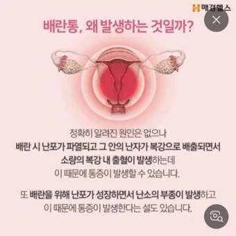 배란통 증상 및 시기 원인_28