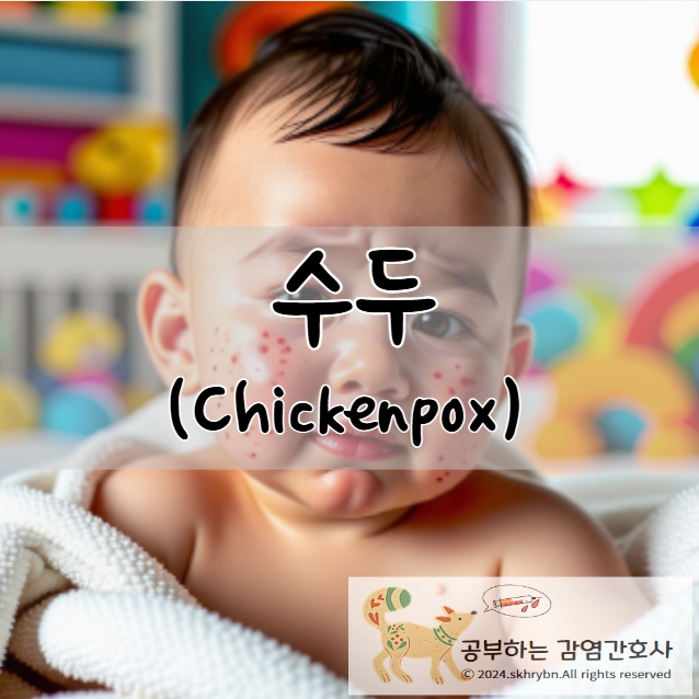 아동 간호_수두(Chickenpox)의 원인, 증상, 치료, 간호 진단