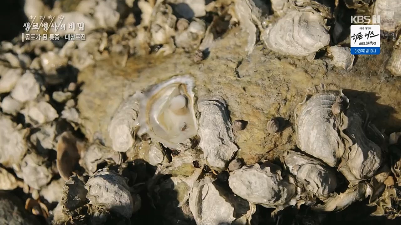 생로병사의 비밀.E857.230223p.H264-F1RST.mp4_20230223_202259.243.jpg