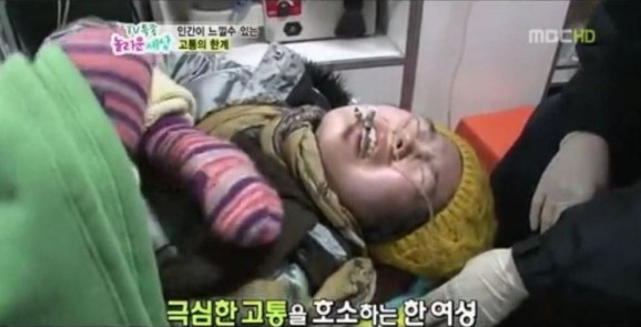  CRPS 복합부위통증증후군, 세상에서 가장 고통스러운 병