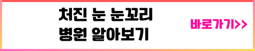 처진눈 눈꼬리 병원 알아보기