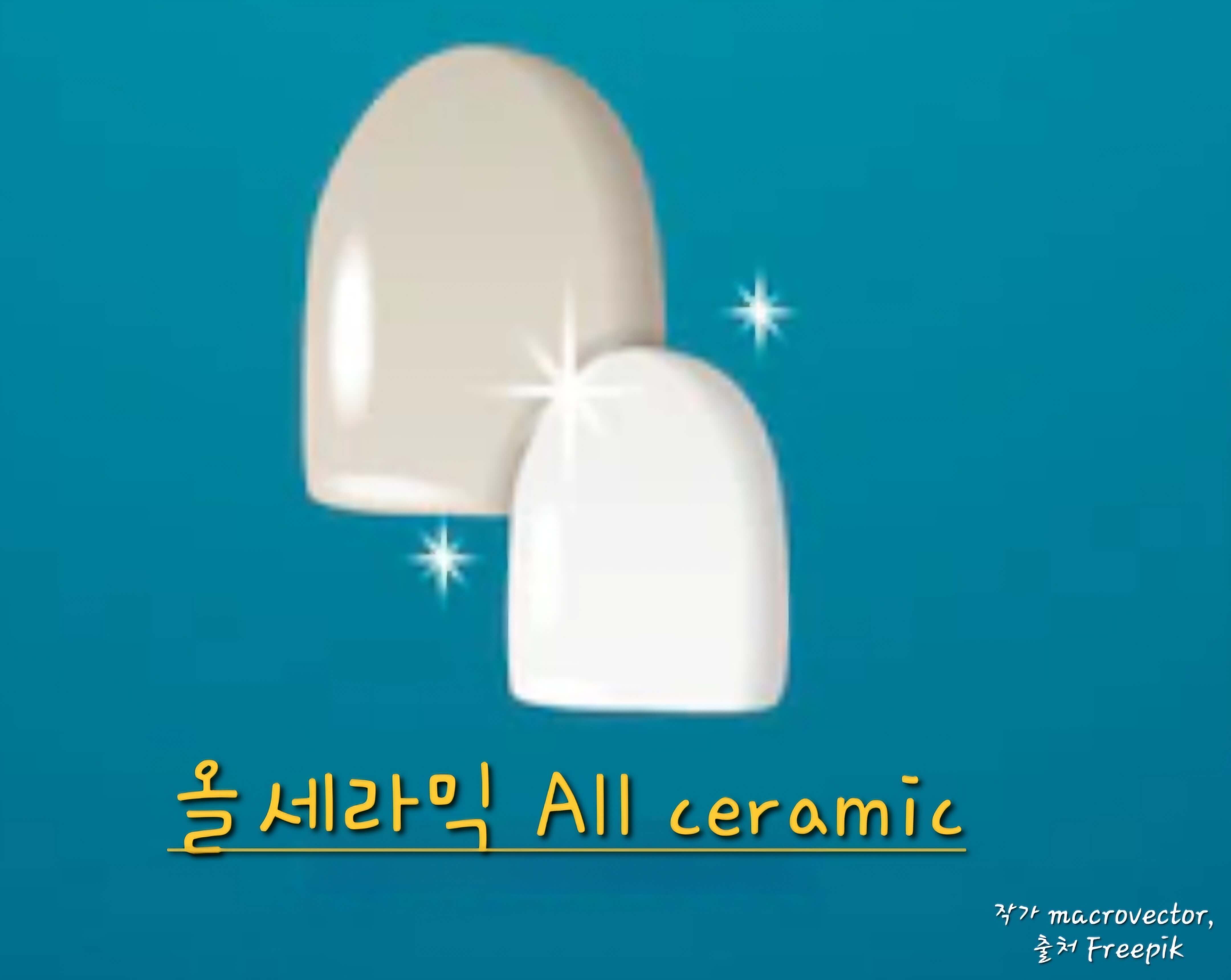 올세라믹 보철사진