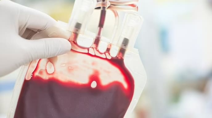  혈액형으로 조기 뇌졸중위험성 알 수 있어 Why your blood type could predict your stroke risk: