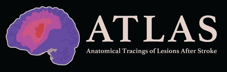  POSTECH·ETRI·서울아산병원, 세계 최고 의료 인공지능 대회서 2위   POSTECH-ETRI-AMC Win 2nd Place At World’s Top Medical AI Competition
