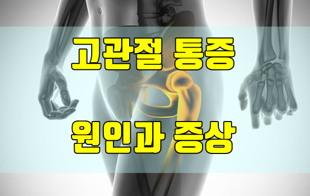  고관절통증 원인과 증상