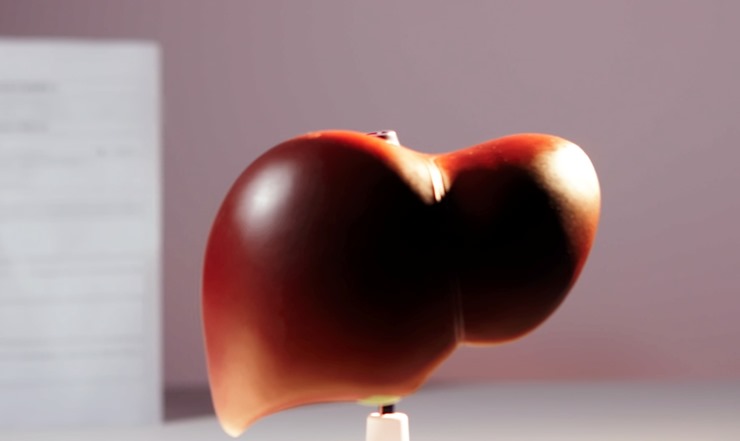 간-모양