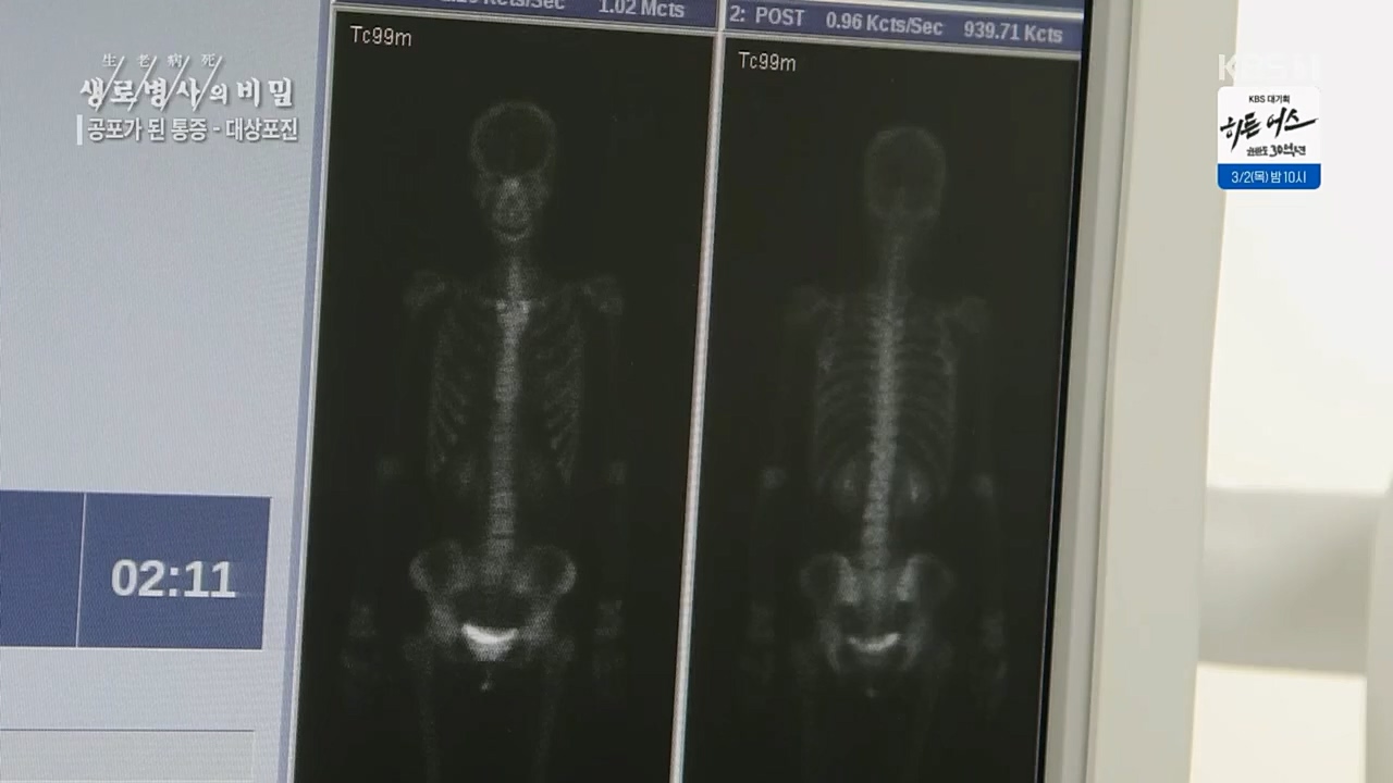 생로병사의 비밀.E857.230223p.H264-F1RST.mp4_20230223_202255.473.jpg