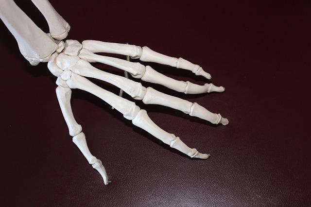 손목통증원인 6 관절염