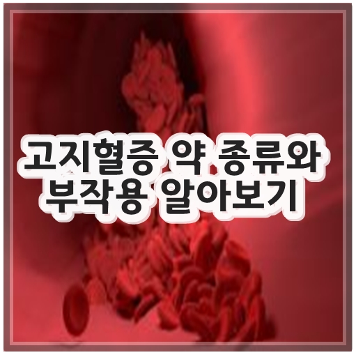 고지혈증 약 종류와 부작용 알아보기