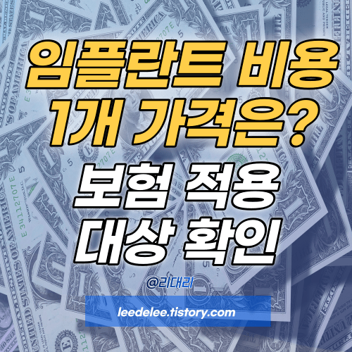 임플란트 비용