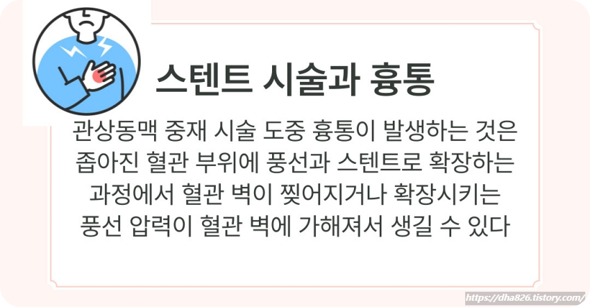 스텐트 시술과 흉통