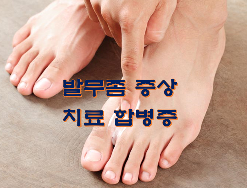  발무좀 증상 치료 합병증