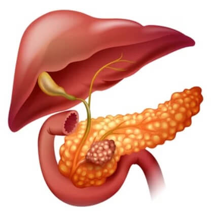  췌장의 역할, 췌장암 검사