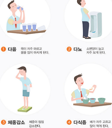 당뇨병 - 전형적인 - 초기 - 증상 - 사진