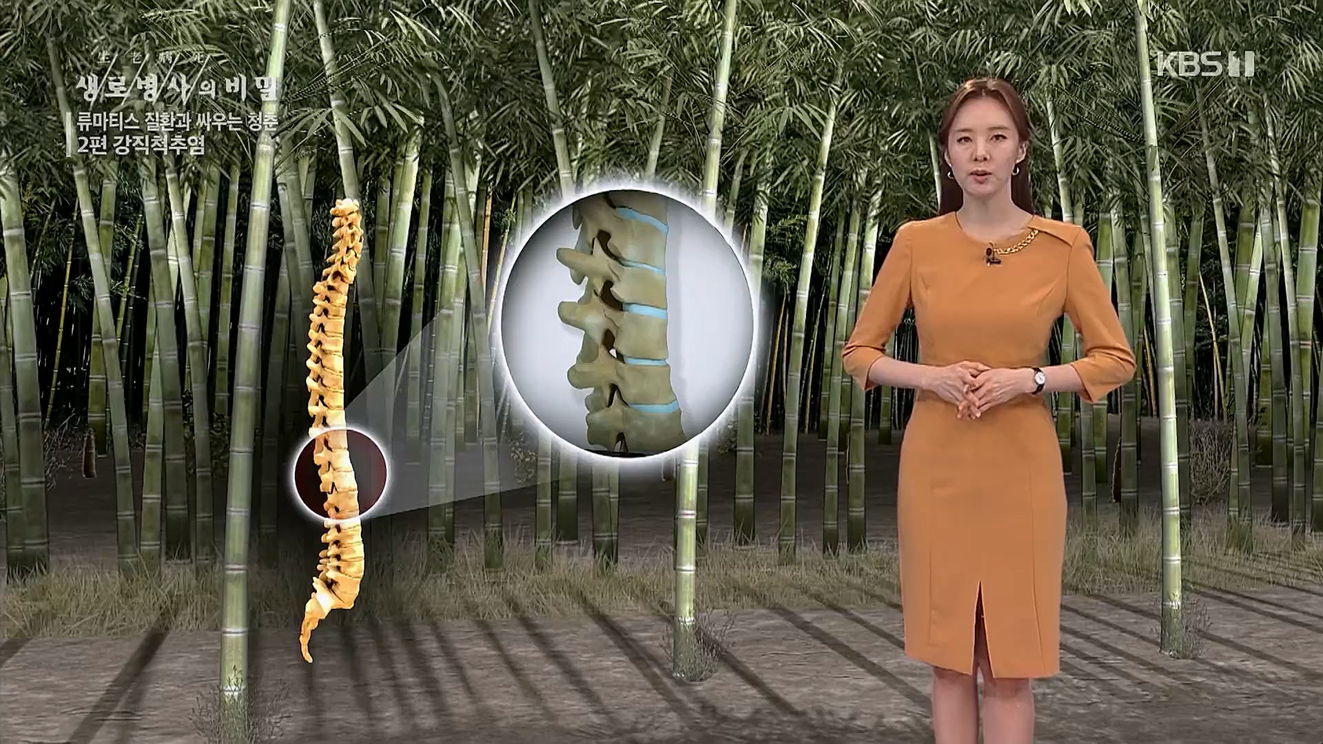 생로병사의 비밀.E861.230322p.H264-F1RST.mp4_20230323_204406.773.jpg