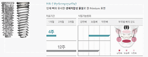 오스템 임플란트 종류 BA