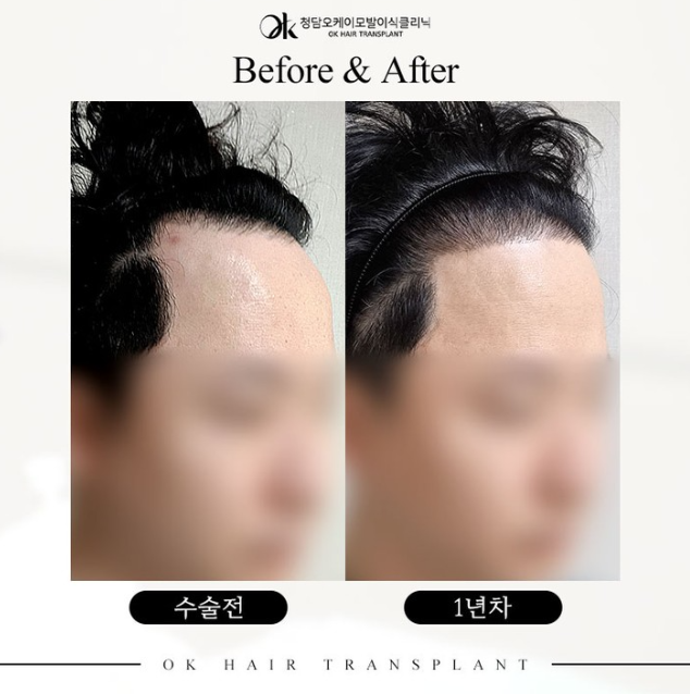 이미지헤어라인 이미지