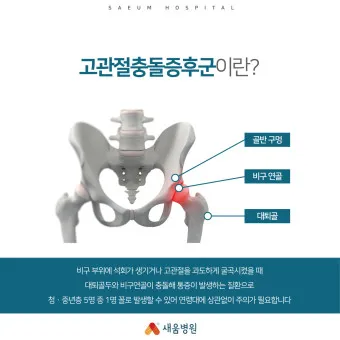 고관절 통증 증상 확인하기_3