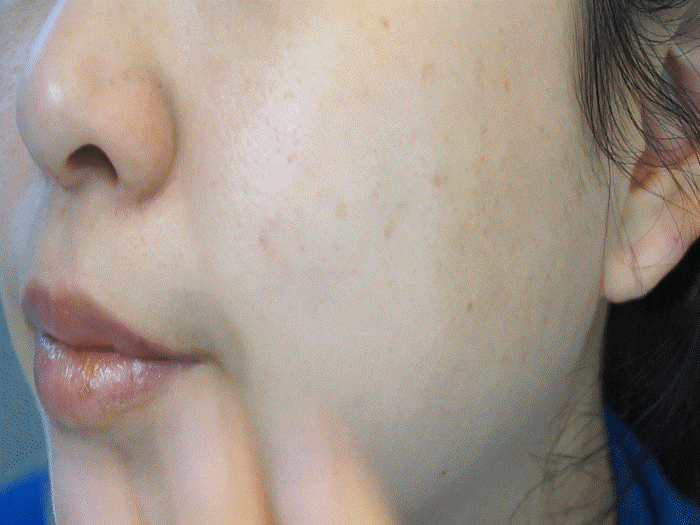 ginger 스킨케어의 시작은 이중기능성토너인 12