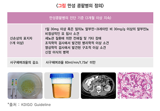만성 이미지