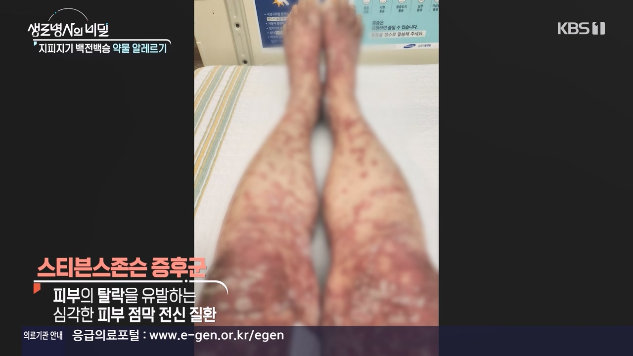 생로병사의 비밀.E910.240509p-NEXT.mp4_20240509_202508.436.jpg
