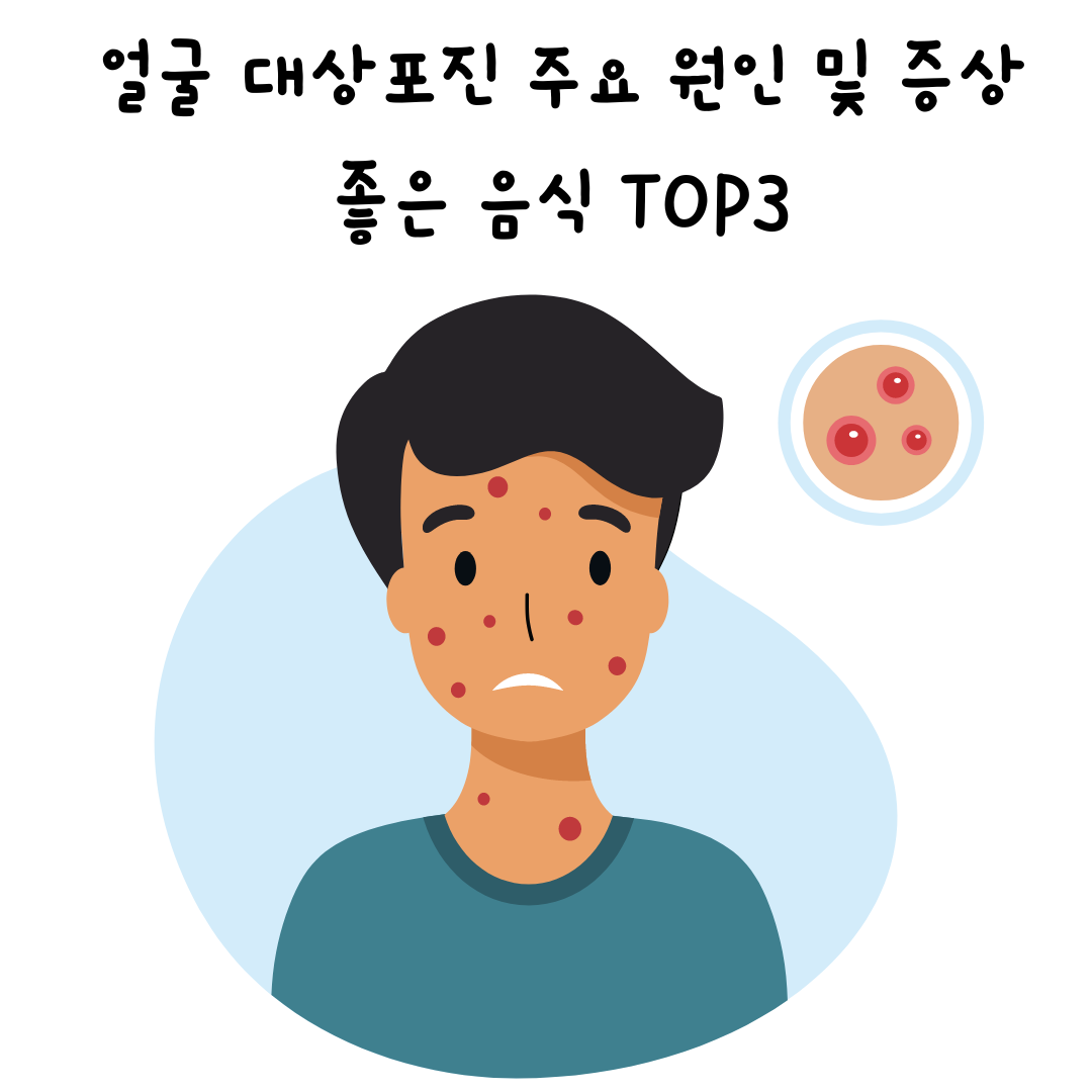  얼굴 대상포진의 원인과 얼굴 대상포진에 좋은 음식 Top3