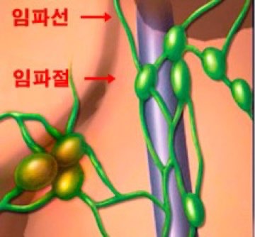 목에_멍울_임파선염_원인_증상_자가진단