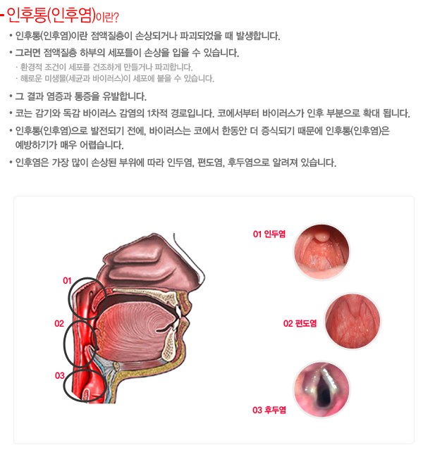 인후통 사진