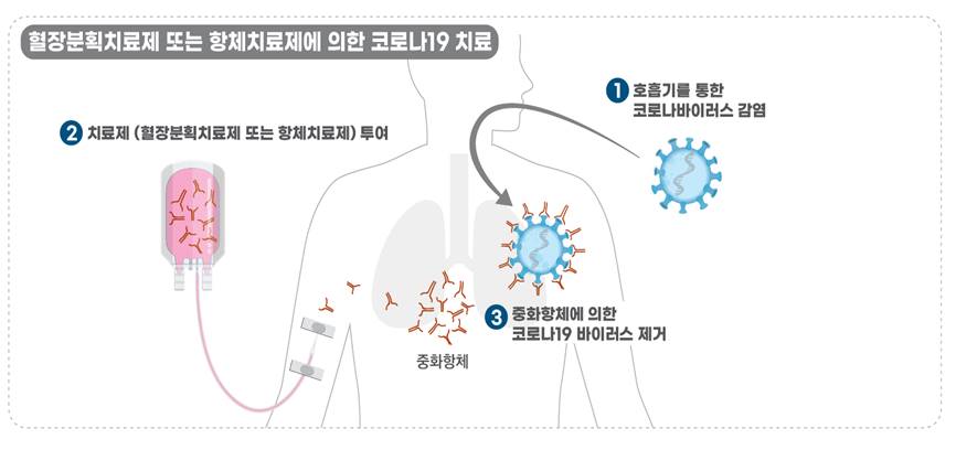 혈장치료제