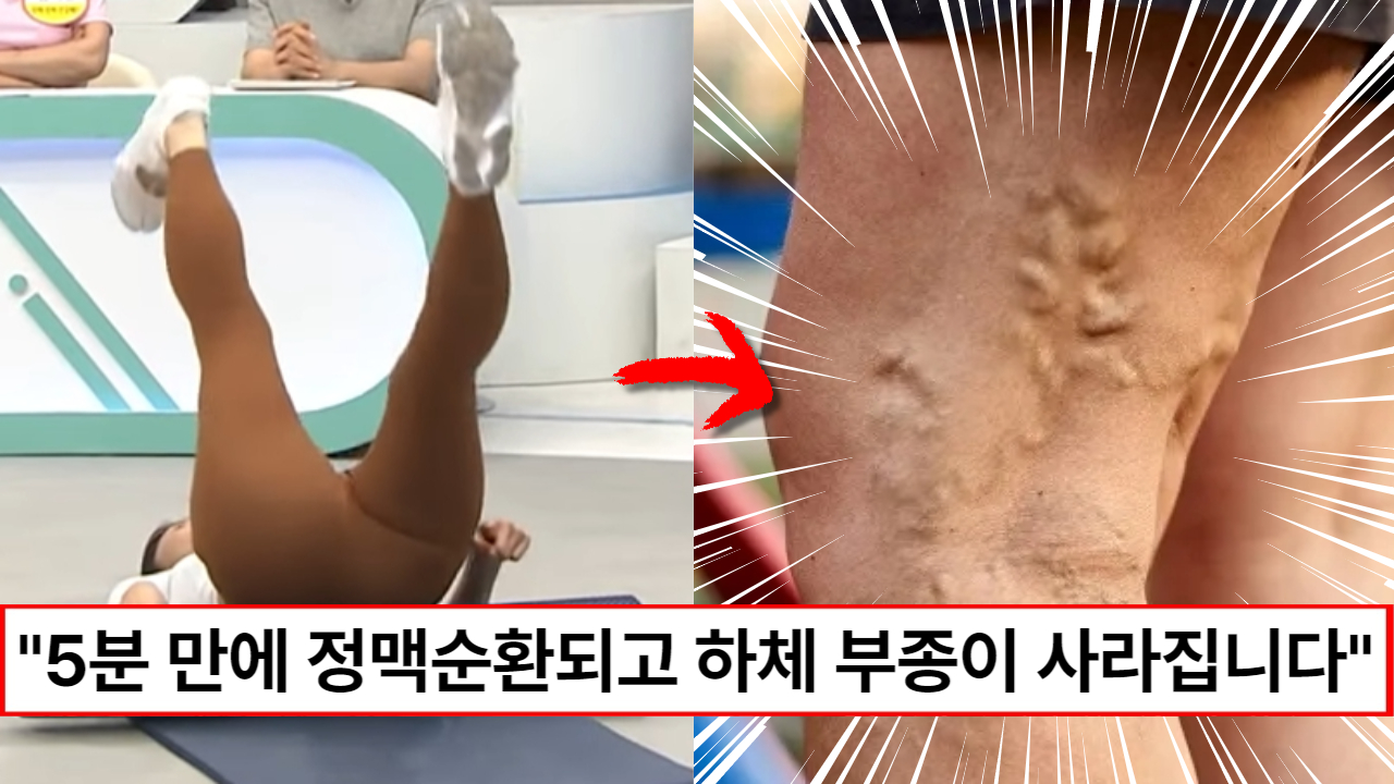 "속는셈치고 딱 5분만 해보세요" 정맥순환을 촉진하여 하체 부종을 줄이고 고관절과 연골을 튼튼하게 만드는 바람개비 운동법