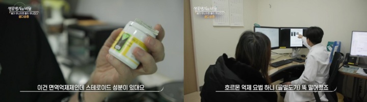 생로병사의비밀-골다공증-진단-예방