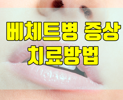  베체트병 증상 및 치료방법 정리