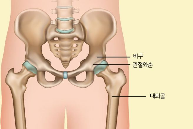 엉치 통증 원인