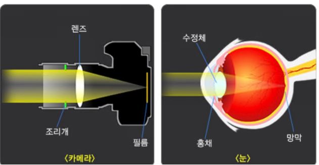 백내장-수술비용-증상