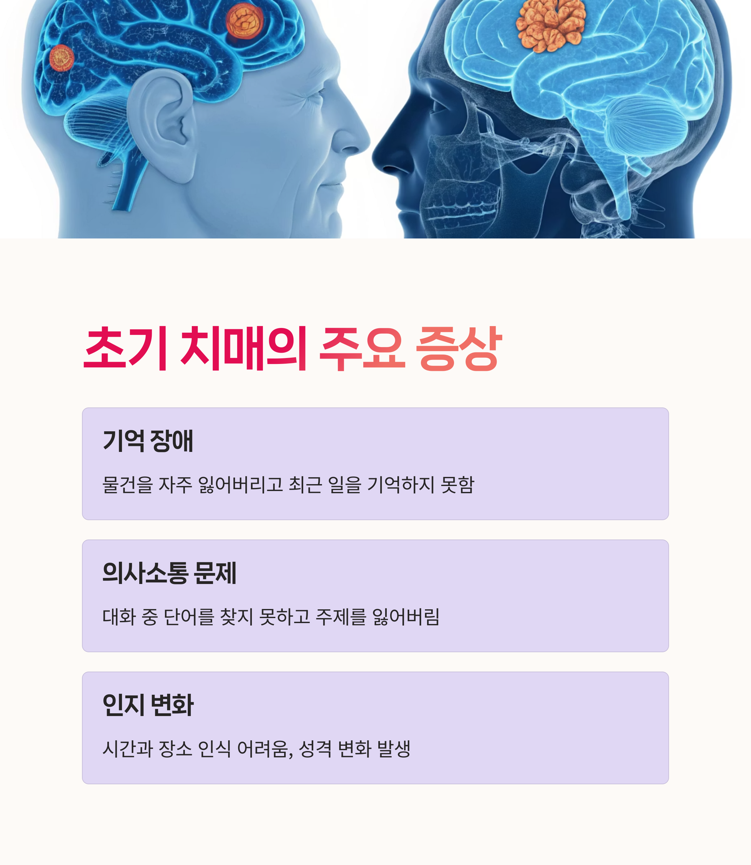 기억력저하, 뇌건강,