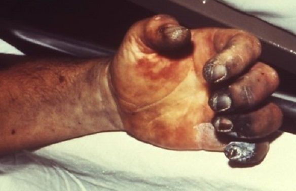  中서 또… 이번엔 ‘흑사병’ 발생, ‘3단계 경계령 발령’