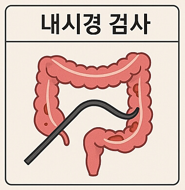 내시경검사