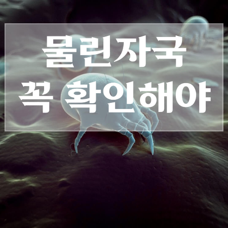 진드기-물린-후-증상